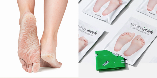 Hot Weather Foot Care: Keep Your Feet Fresh and Flawless in the Heat!