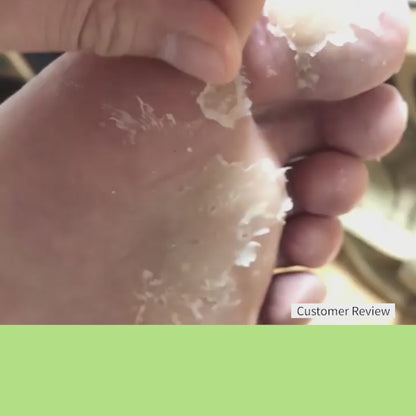Good-bye Dirty Foot Solution