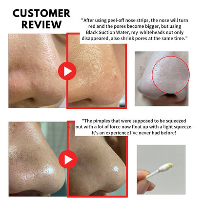 Blackhead Suction Water (blackhead remover cleanser)